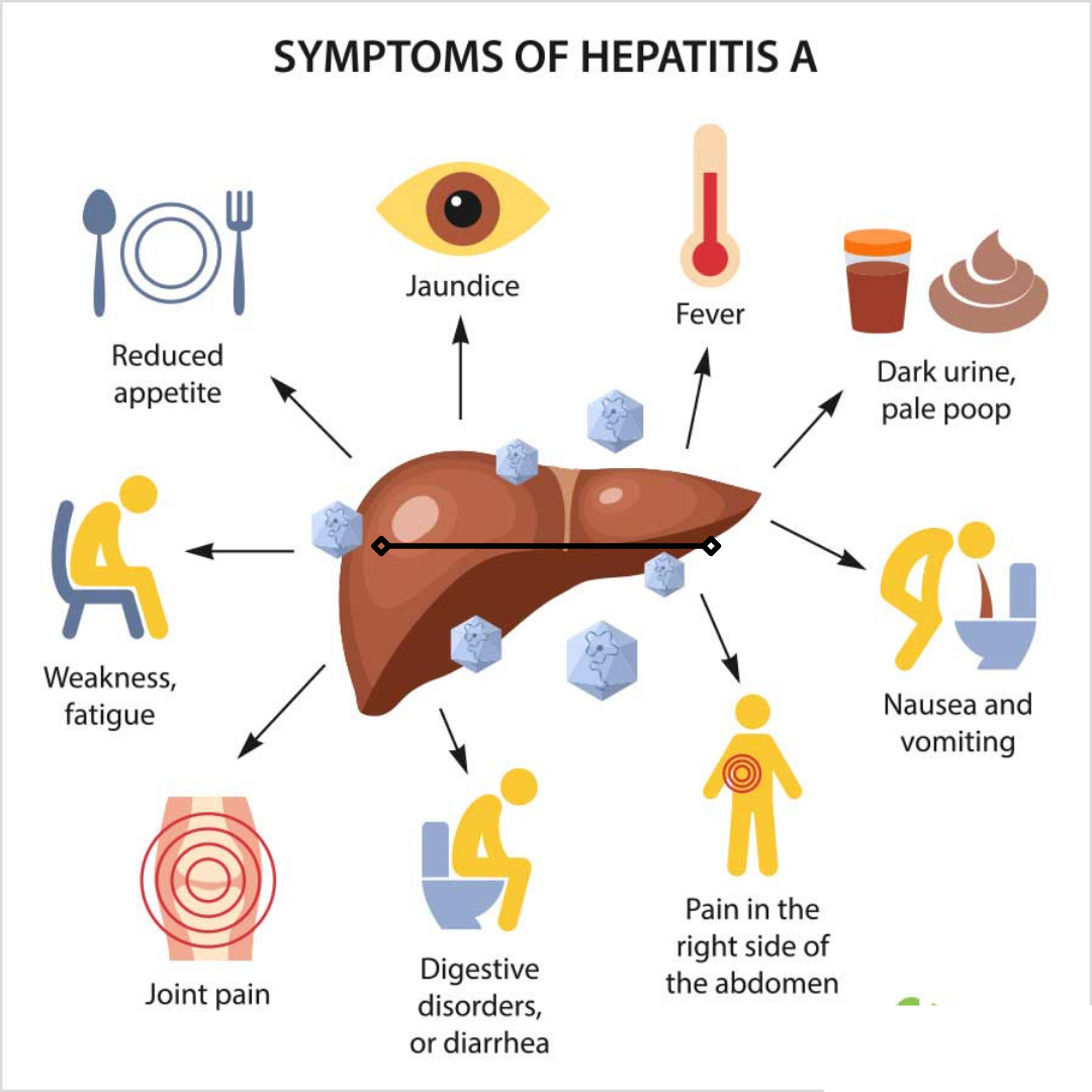 Read more about the article Symptoms, Treatment, and Prevention of Hepatitis