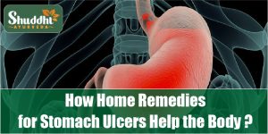 Read more about the article How home remedies for stomach ulcers help the body?