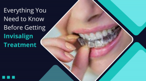 Read more about the article Everything You Need to Know Before Getting Invisalign Treatment
