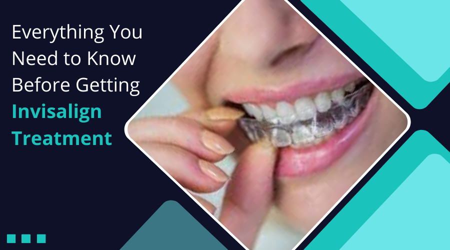 You are currently viewing Everything You Need to Know Before Getting Invisalign Treatment