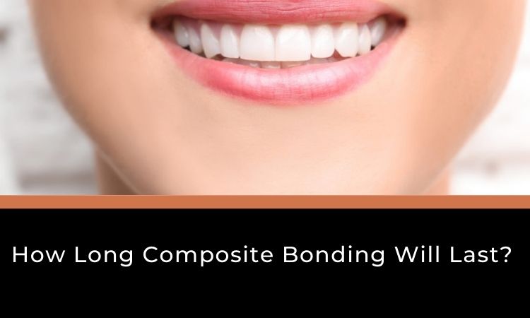 You are currently viewing How Long Composite Bonding Will Last in Your Teeth?