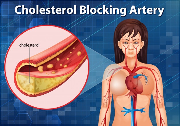 You are currently viewing How To Choose Medications That Lower Cholesterol