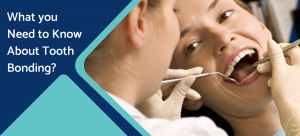 Read more about the article What you Need to Know About Tooth Bonding?