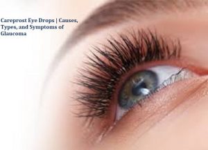 Read more about the article Careprost Eye Drops | Causes, Types, and Symptoms of Glaucoma