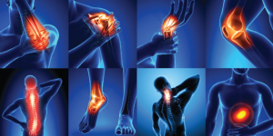 Read more about the article Which medication is the most effective for joint pain?
