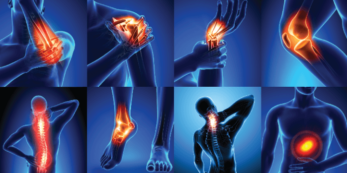 You are currently viewing Which medication is the most effective for joint pain?