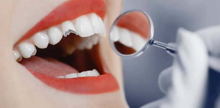 Read more about the article How dentists repair a cracked or broken tooth