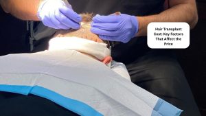 Read more about the article Average Cost of Hair Transplant & Key Factors That Affect It
